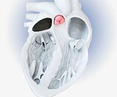 心脏瓣膜中心